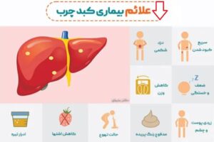 علائم و نشانه های کبد چرب