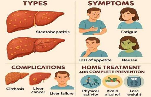 کبد چرب: انواع، علائم، عوارض و درمان خانگی و پیشگیری کامل